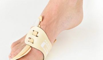 Hallux valgus splint - links - Neo G