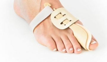 Hallux valgus splint - links - Neo G