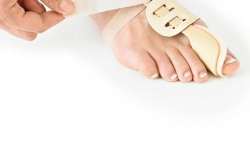 Hallux valgus splint - links - Neo G