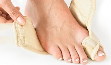 Hallux valgus soft support - links